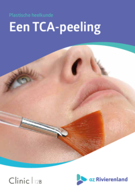 TCA peeling